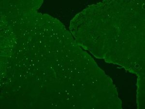 Ataxia sparkles under microscope